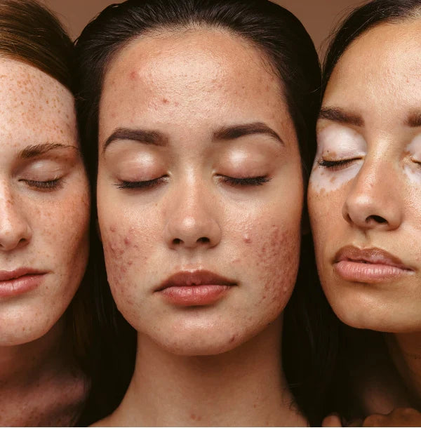 Pureté et transformation